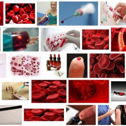 Eigenbluttherapie | (An)reizen des körpereigenen Immunsystems Eigenbluttherapie Bilder (Screenshot der Google-Bild-Suche zum Stichwort 'eigenblut-therapie' am 04.07.2013)