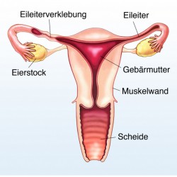 Eileiterentzündung | Ursachen, Beschwerden, Behandlung © Henrie - Fotolia.com