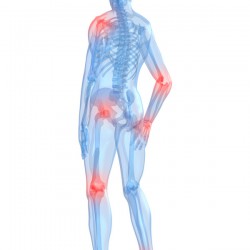 Nahrungsergänzungsmittel, die gut für Gelenkprobleme sein sollen Schmerzende Gelenke an Knie, Ellbogen, Schultern, Fuß, Hüfte und Hand (© Sebastian Kaulitzki / Fotolia)