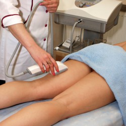 Haare an den Beinen per Lasertherapie entfernen Laser Epilation: Bein-Enthaarung per Laser (© terex - Fotolia.com)