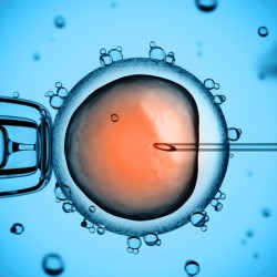 Intrazytoplasmische Spermieninjektion Intrazytoplasmische Spermieninjektion (© koya979 - Fotolia.com)