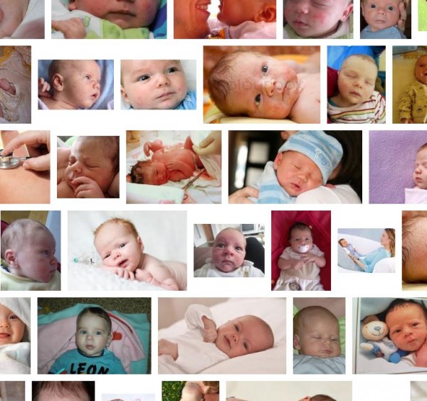 Neugeborenenakne Bilder: Ein Blick in die Google-Bildersuche zeigt die unterschiedlichen Ausprägungen von Akne bei neugeborenen Babys (Screenshot images.google.de am 20.12.2012)