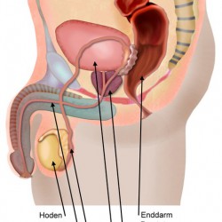 Prostatahyperplasie: vergrößerte Prostata, Restharn in der Blase, häufiger Harndruck Prostata: Position (© Elvira Gerecht / Fotolia)