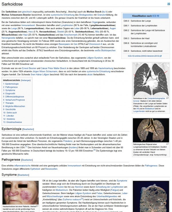 Sarkoidose Kurz erklärt (Erkrankung des Bindesgewebes)