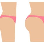 BBL OP | Kosten und Risiken der Brazilian Butt Lift Operation (© zhenyakot / stock.adobe.com)