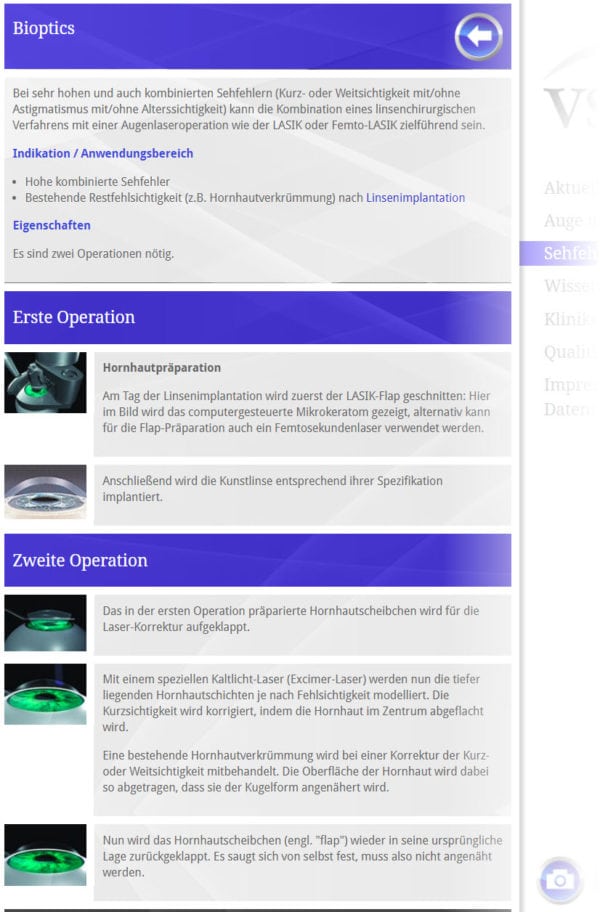 Linsenimplantat + LASIK = Bioptics | Der VSDAR erläutert den Ablauf von Augenlinse OP (ICL Linse / Intraokularlinse) plus Augenlaserung (Screenshot vsdar.de/sehfehlerkorrekturen/sonstige-verfahren/bioptics/ am 01.06.2018)