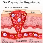 Der Vorgang der Blutgerinnung (© Henrie - Fotolia.com)