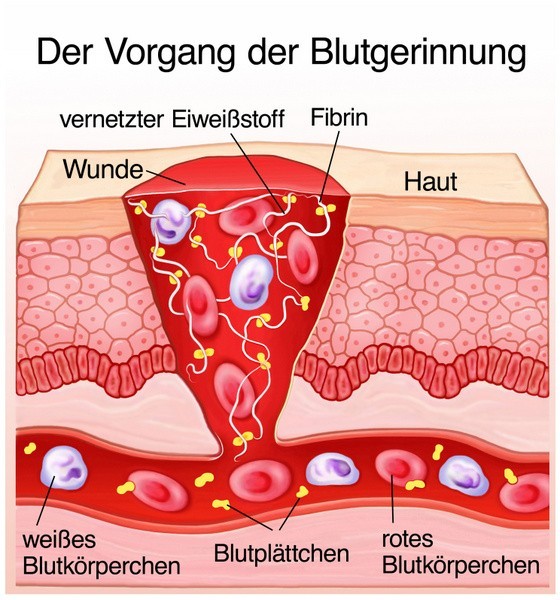 Der Vorgang der Blutgerinnung (© Henrie - Fotolia.com)