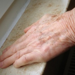 Braune Flecken am Handrücken Braune Flecken am Handrücken sind im Alter eine verbreitete Erscheinung und werden in der harmlosen Form Altersflecken genannt (© hean - Fotolia.com)