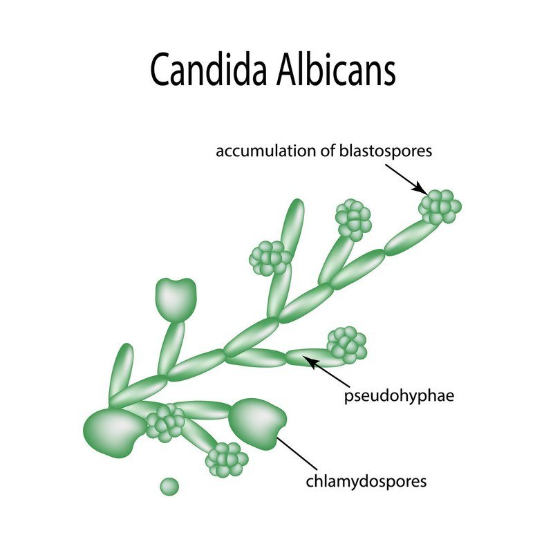 Hefepilze der Art "Candida Albicans" können als Darmpilze Symptome auslösen, die erst einmal unspezifisch sind (© timonina / Fotolia)
