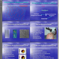 Crosslinking erklärt: Kollagen-Quervernetzung in der Hornhaut des Auges mit Riboflavin / Vitamin B2 und UV-A-Bestrahlung zur Behandlung des Keratokonus Präsentation / Vortrag zum Thema Crosslinking als PDF (Medizinische Hochschule Hannover, https://www.mh-hannover.de/fileadmin/organisation/ressort_krankenversorgung/downloads/innovationsgipfel/ig6/6__Blomberg_Hornhaut_Crosslink_neue_ambulante_Behandlungsform.pdf)