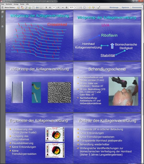 Präsentation / Vortrag zum Thema Crosslinking als PDF (Medizinische Hochschule Hannover, https://www.mh-hannover.de/fileadmin/organisation/ressort_krankenversorgung/downloads/innovationsgipfel/ig6/6__Blomberg_Hornhaut_Crosslink_neue_ambulante_Behandlungsform.pdf)