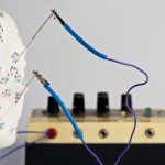 Die Elektro-Akupunktur ist eine besondere Form der Elektrotherapie (© hjschneider/Fotolia)