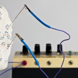 Elektrotherapie – eine reizende Art der Behandlung Die Elektro-Akupunktur ist eine besondere Form der Elektrotherapie (© hjschneider/Fotolia)