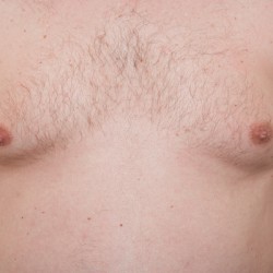 Falsche Gynäkomastie Falsche Gynäkomastie? (© semmickphoto - Fotolia.com)