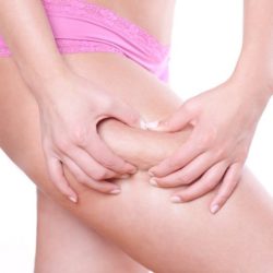Fett absaugen: Methoden der Liposuktion und ihre Risiken; Kosten / Preisbeispiele der Behandlung im Inland vs. Ausland Fett absaugen am Oberschenkel | Das Fettabsaugen (Liposuktion) ist ein beliebtes und probates Mittel im Rahmen der Schönheitschirurgie (© detailblick / Fotolia)