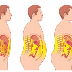 Fettleibigkeit | Arten, Ursachen, Behandlungsansätze Die Entwicklung von Fettleibigkeit (© rob3000 - Fotolia.com)