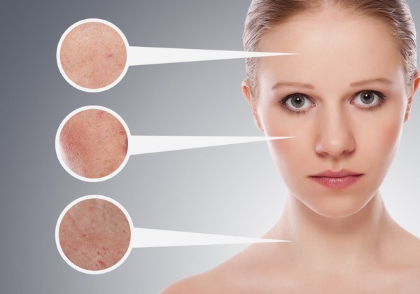 Hautverjüngung: Es gibt verschiedene Methoden und Techniken mit Namen wie Skin-Tightening, IPL, Thermolyse oder auch nur die 'einfache' Behandlung mit Hyaluronsäure (© evgenyatamanenko - Fotolia.com)