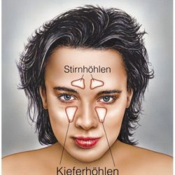 Kieferhöhlenentzündung | Symptome, Dauer und Behandlung durch Hausmittel & Medikamente Stirn- und Kieferhöhlen | Eine Kieferhöhlenentzündung ist kein Spaziergang, lässt sich aber u.a. durch Medikamente behandeln (© Henrie / Fotolia)