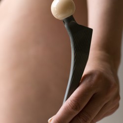 Künstliche Gelenke – bald auch unendlich haltbar? Künstliches Hüftgelenk: Künstliche Gelenke sind heute ein verbreitetes Thema in der Medizin, aber noch wird an länger haltbaren Materialien und Lösungen geforscht (© alephnull / Fotolia)