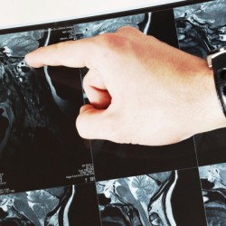 Magnetresonanztomografie – die medizinische Scheibenwelt Arzt bei der Untersuchung (© yannickpi - Fotolia.com)