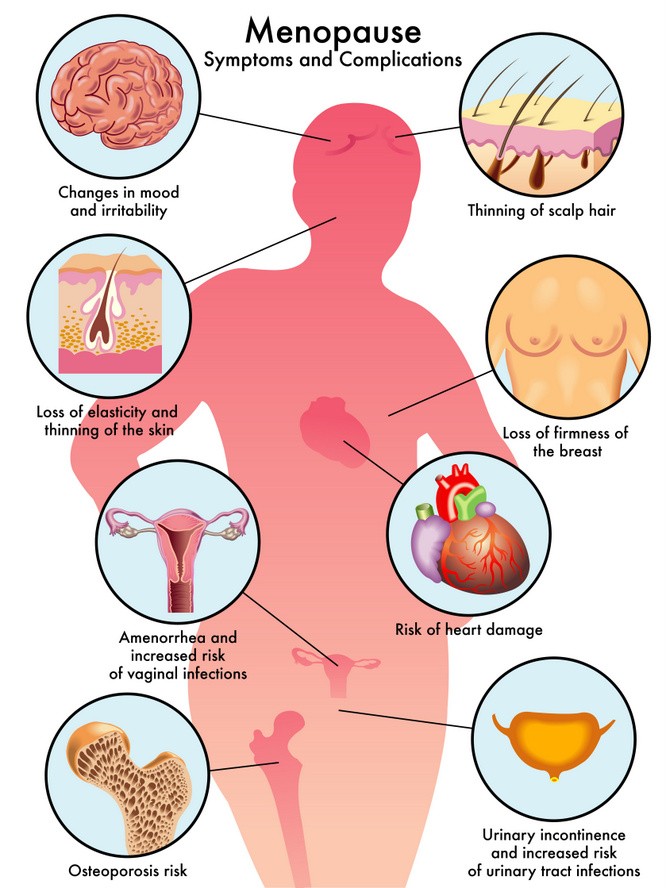 Symptome der Menopause / Wechseljahre (englisch) - © rob3000 - Fotolia.com