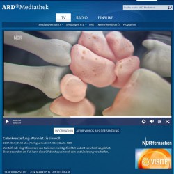 Gelenkversteifung (Arthrodese): Warum man manchmal bei Gelenkproblemen die Gelenke bewusst aktiv versteift TV-Beitrag des NDR zum Thema 'Gelenkversteifung - wann ist sie sinnvoll?' - Screenshot ARD Mediathek, http://www.ardmediathek.de/tv/Visite/Gelenkversteifung-Wann-ist-sie-sinnvoll/NDR-Fernsehen/Video?documentId=22525214&bcastId=14049224