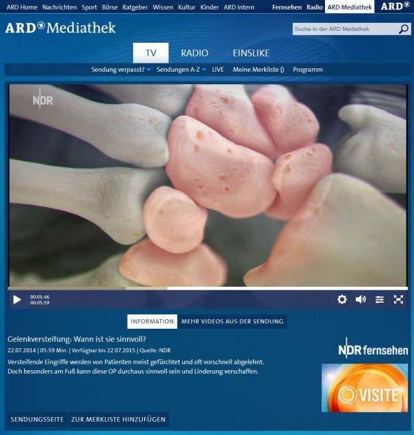 TV-Beitrag des NDR zum Thema 'Gelenkversteifung - wann ist sie sinnvoll?' - Screenshot ARD Mediathek, http://www.ardmediathek.de/tv/Visite/Gelenkversteifung-Wann-ist-sie-sinnvoll/NDR-Fernsehen/Video?documentId=22525214&bcastId=14049224