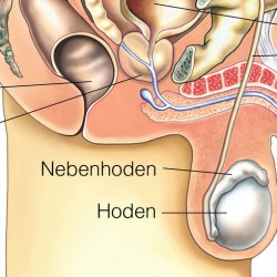 Nebenhodenentzündung: Infektion der Nebenhoden Der Nebenhoden (© Henrie / Fotolia)