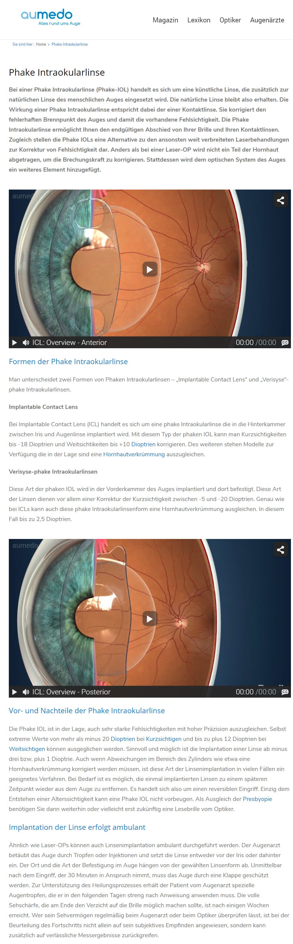 Das Augenportal aumedo.de erläutert sehr schön die zwei Formen von Phaken Intraokularlinsen – „Implantable Contact Lens“ und „Verisyse“-phake Intraokularlinsen - Hinterkammer- vs. Vorderkammer-Linsen