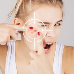 Pickel unter der Haut geht nicht weg – wie entfernen, was tun? <br>Ausdrücken, aufstechen, mit Zugsalbe behandeln? Pickel unter der Haut geht nicht weg - wie entfernen? - Ausdrücken? Aufstechen? (© transurfer / Fotolia)