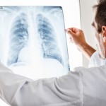 Arzt schaut sich eine Röntgenaufnahme an (© Minerva Studio - Fotolia.com)