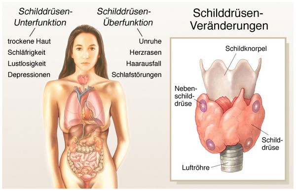 Schilddrüsenunterfunktion: Krankmacher Schilddrüse (© Henrie - Fotolia.com)