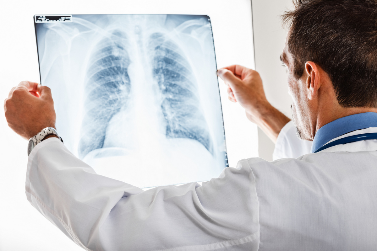 Schmerzen beim Luftholen | Arzt bei der Lungendiagnose (© Minerva Studio / Fotolia)