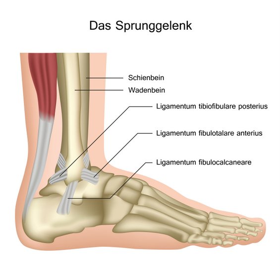 Anatomie des Sprunggelenks: Bei fortwährenden, gravierenden Problemen mit dem Sprunggelenk stellen Ärzte mitunter einer bewusst durchgeführte Versteifung des Gelenks zur Option (© bilderzwerg / Fotolia)