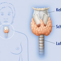 Erklärt: Die Unterfunktion der Schilddrüse (Hypothyreose) Unterfunktion der Schilddrüse: Wo genau befindet sich die Schilddrüse (© lom123 - Fotolia.com)