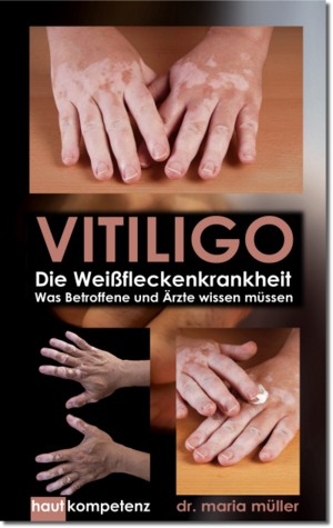 eBook: VITILIGO - Die Weißfleckenkrankheit (Amazon Kindle eBooks)