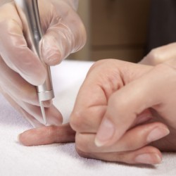 Vereisung – Warzen und Tumore abtöten Warzen entfernen durch Vereisung oder mit Laser? (© bartekwardziak - Fotolia.com)
