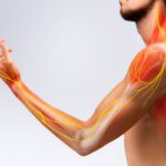 Wie macht sich eine Nervenentzündung im Arm bemerkbar? (© Big Blue Studio / stock.adobe.com)