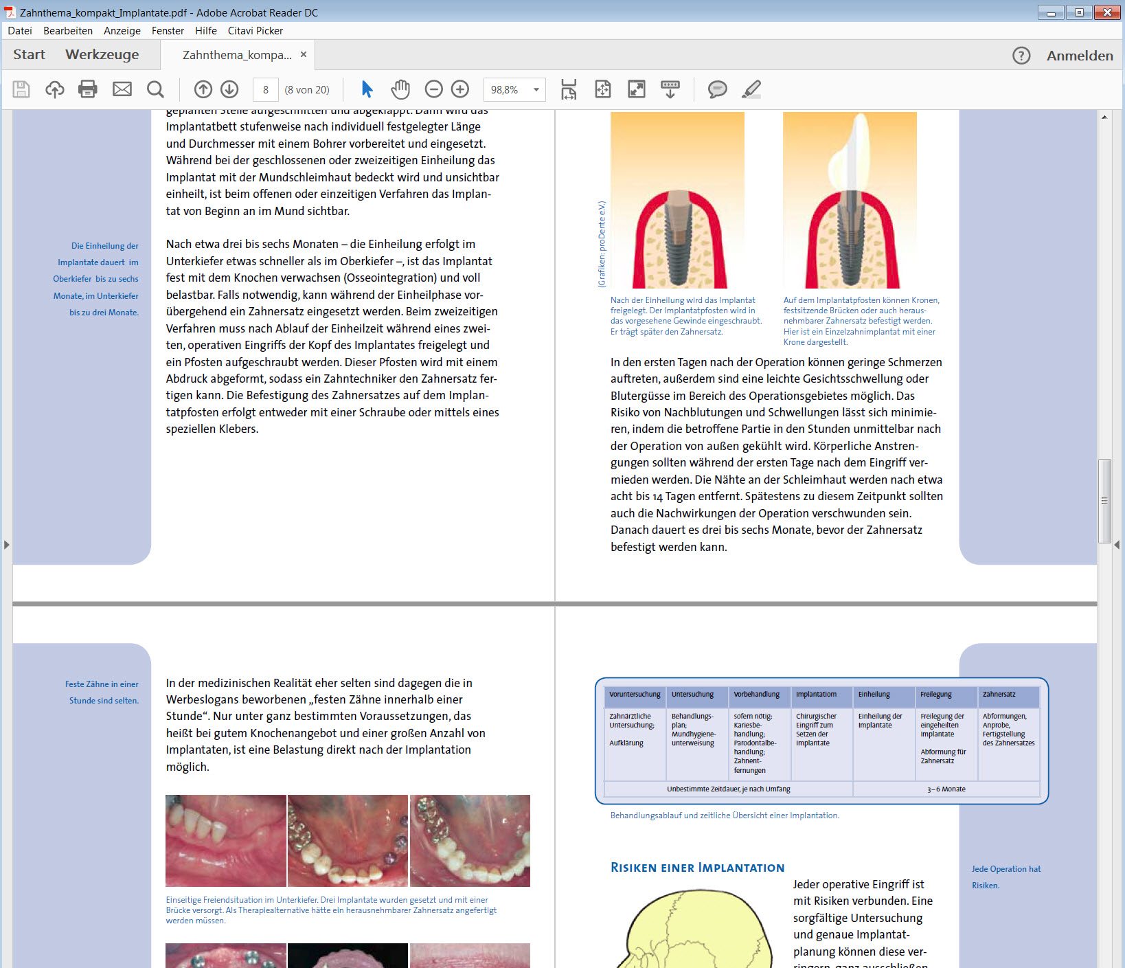 Interessante Übersicht rund um das Thema Zahnimplantate in PDF-Form (http://www.agz-rnk.de/agz/download/1/Zahnthema_kompakt_Implantate.pdf?m=1433949196)